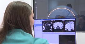 Најмладиот со мозочен удар 15 години: Македонски тим со врвно истражување објавено во Лондон